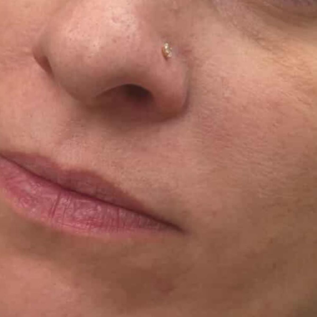 Avant : des lèvres naturelles, pâles et au contour peu défini, avant une séance de Candy Lips chez Claire Degli-Esposti à Aix-les-Bains