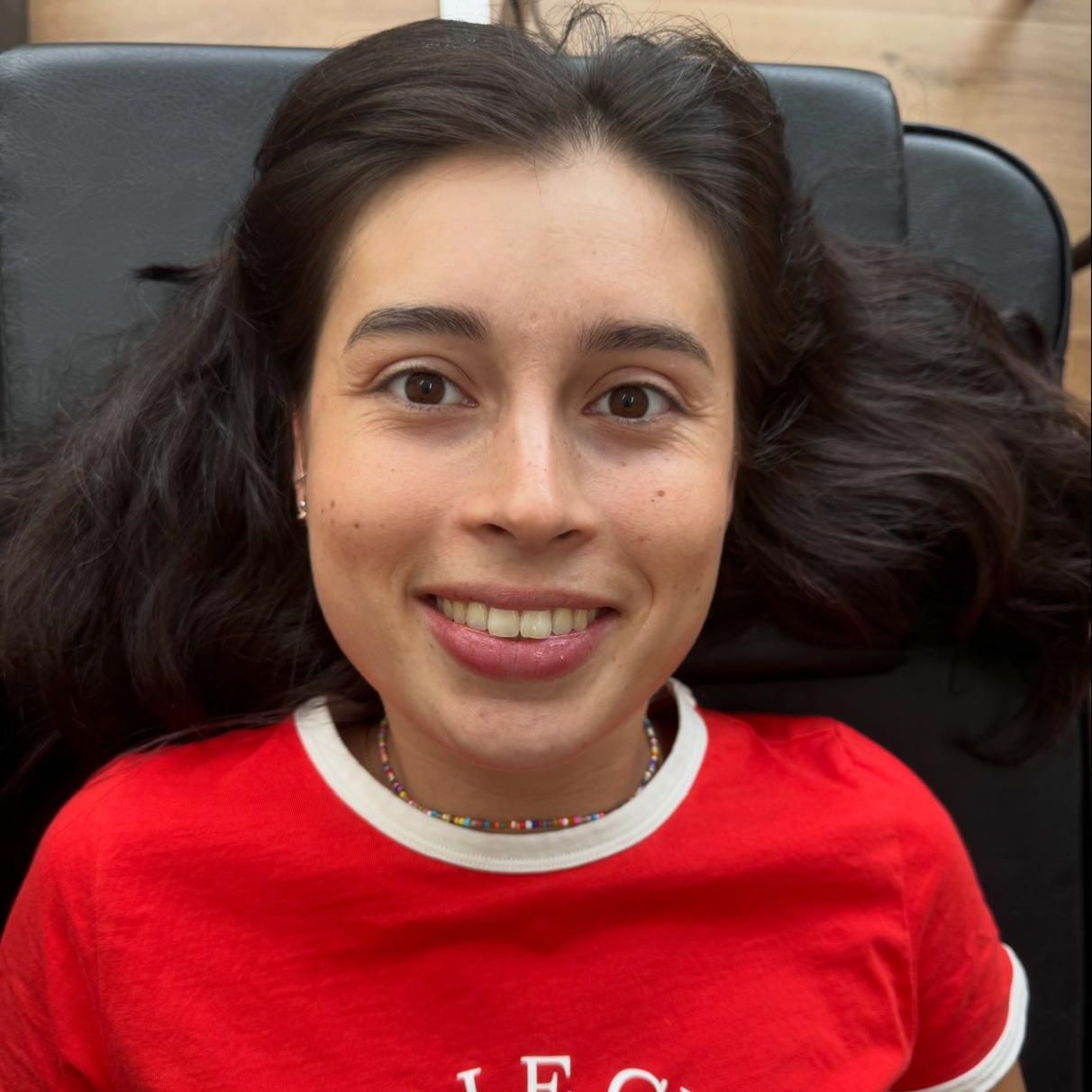 Avant : le visage d'une cliente sans taches de rousseur, avant sa séance chez Claire Degli-Esposti à Aix-les-Bains